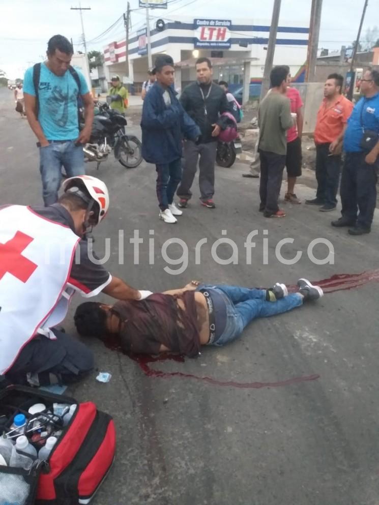  La mañana de este domingo, un joven perdió la vida y dos más resultaron lesionados luego de derrapar la motocicleta en la que viajaban sobre la carretera federal Xalapa - Veracruz a la altura de la colonia Amapolas.