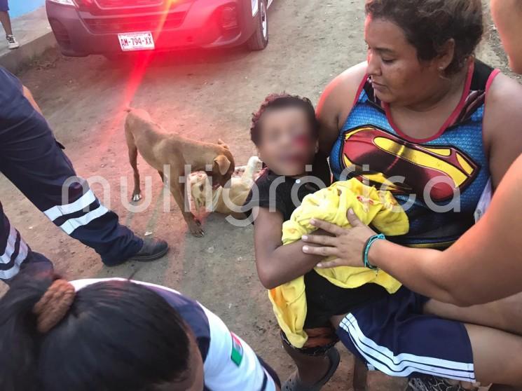 El niño Pablo Quintero perdería el ojo izquierdo a consecuencia de la explosión de un cuete. El pequeño encontró el explosivo y se acercó a encenderlo a un fogón, pero este le explotó en la cara. Los hechos ocurrieron en la colonia Las Flores de El Tejar, municipio de Medellín de Bravo.